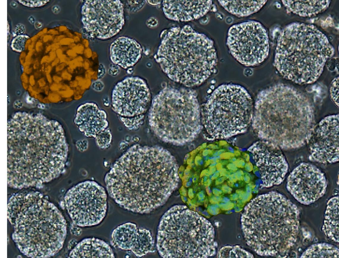 naive pluripotent stem cells