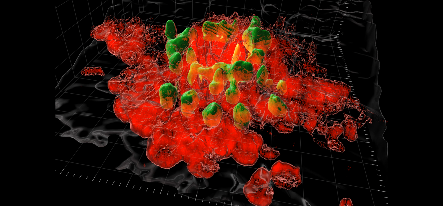 This is the view through a multi-photon microscope as macrophages (red) congregate at an injury site (green) to start to repair the injury. 