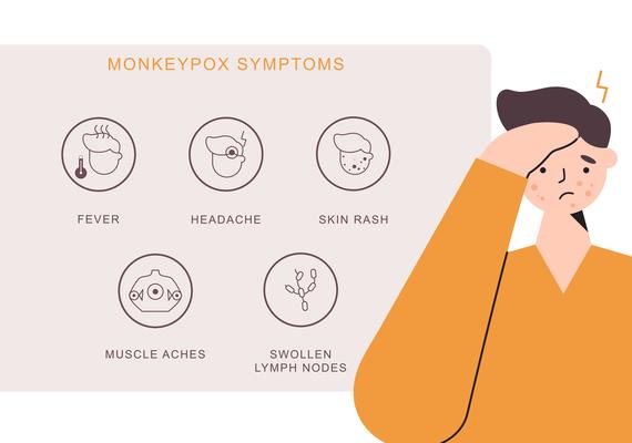 monkeypox infographic