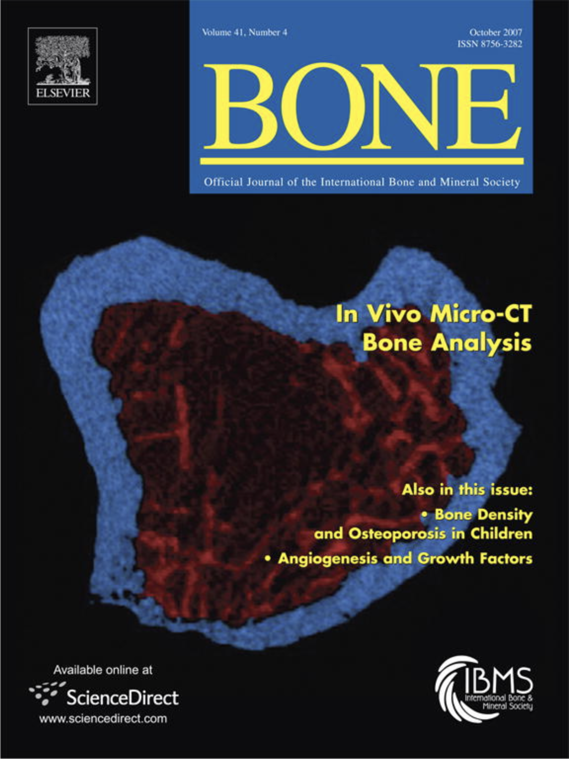 Bone Cover 2007