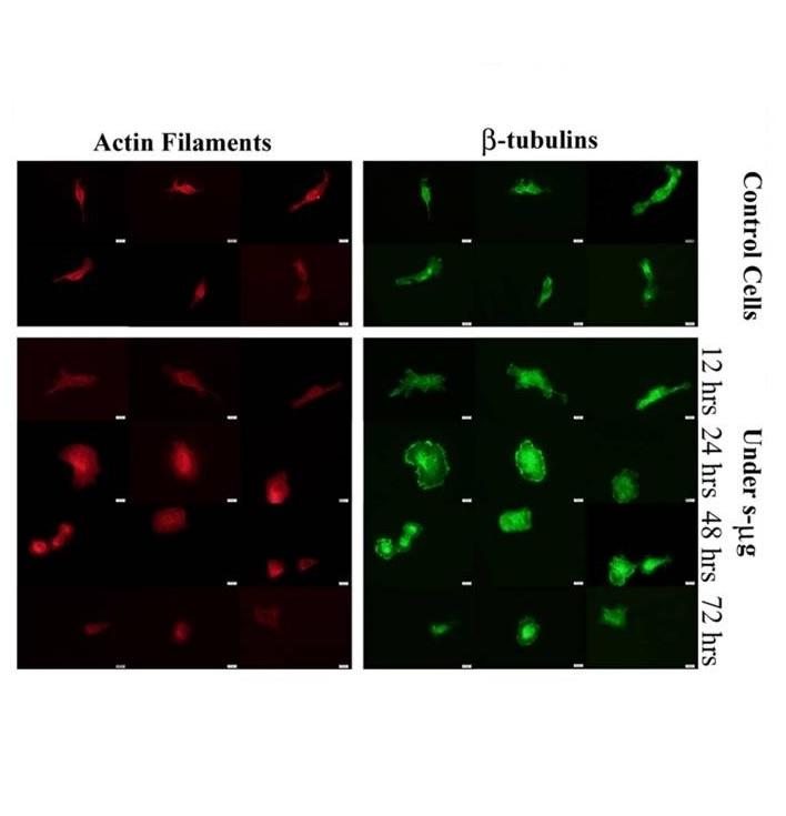 Impact of simulated microgravity on cytoskeleton and viscoelastic properties of endothelial cell Impact of simulated microgravity on cytoskeleton and viscoelastic properties of endothelial cell