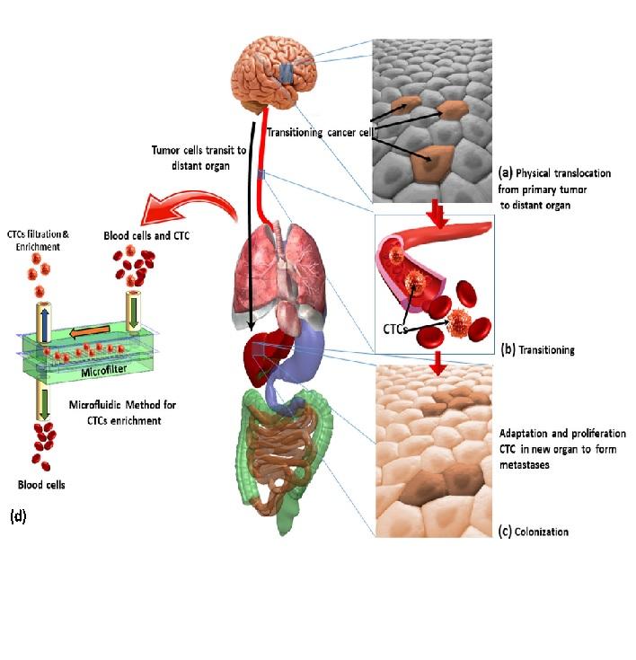 Filter-based Isolation, enrichment and characterization of circulating tumor cells