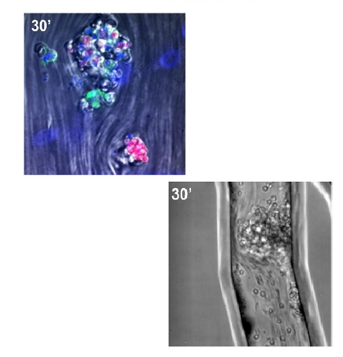Leukotriene B4-mediated neutrophil recruitment causes pulmonary capillaritis during lethal fungal sepsis Leukotriene B4-mediated neutrophil recruitment causes pulmonary capillaritis during lethal fungal sepsis