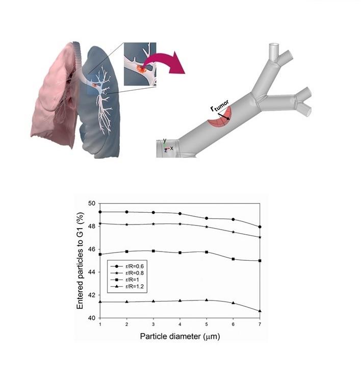 Magnetic aerosol drug targeting in lung cancer therapy using a permanent magnet Magnetic aerosol drug targeting in lung cancer therapy using a permanent magnet