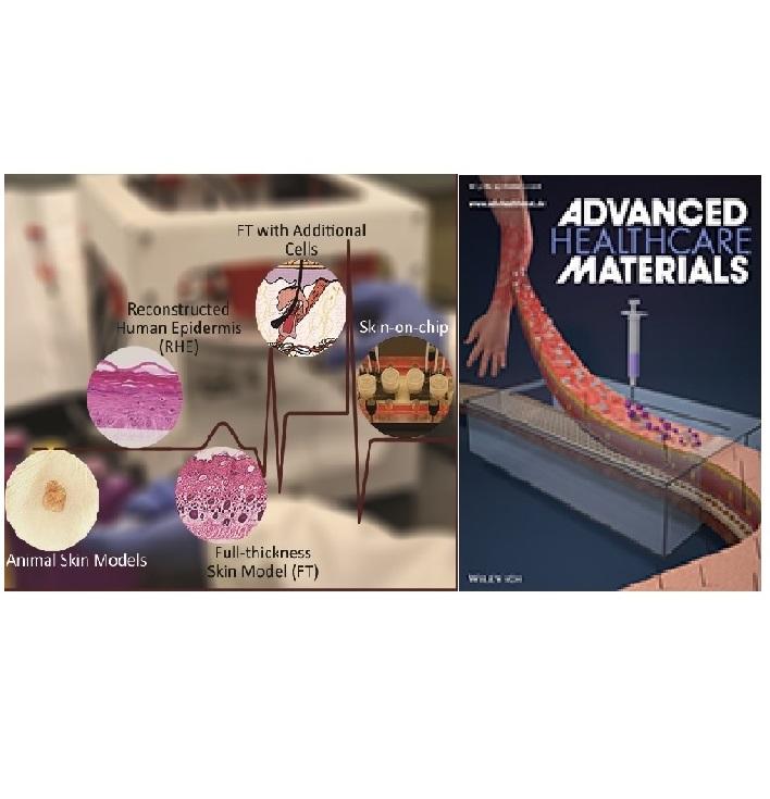 Skin Diseases Modeling using Combined Tissue Engineering and Microfluidic Technologies Skin Diseases Modeling using Combined Tissue Engineering and Microfluidic Technologies
