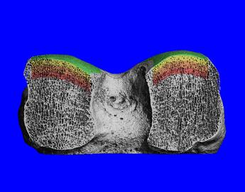 HR-pQCT scan of a human knee