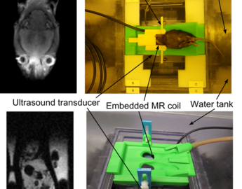 animal coils for HIFU