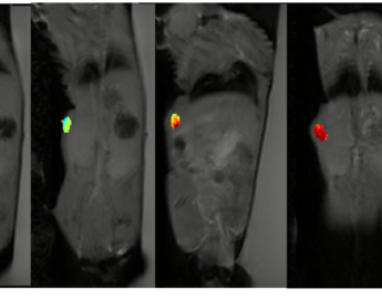 mri probes for HIGU