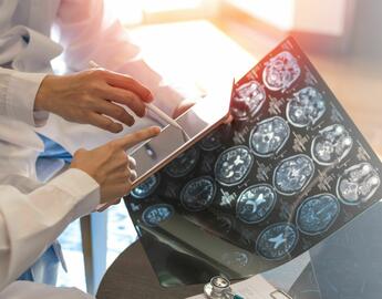 photo of doctors looking at brain scan images 